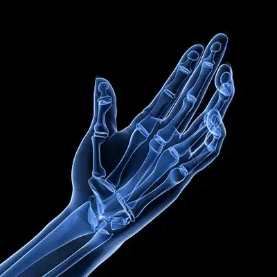 Muñequera Térmica – Alivio Rápido del Dolor y Recuperación Efectiva